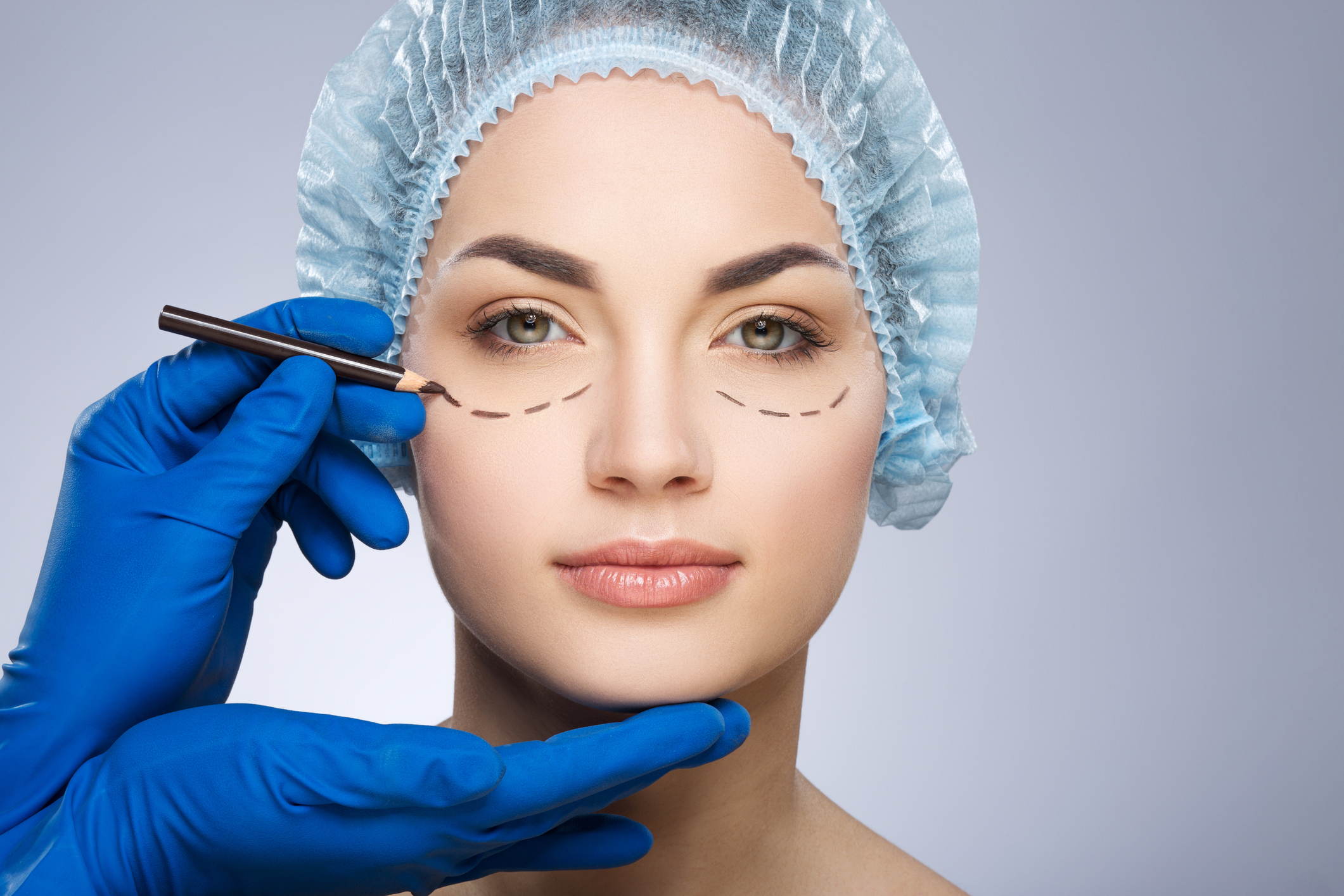 Eye Bag Surgery (Blepharoplasty)