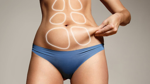 Liposuction (Yağ Emme)