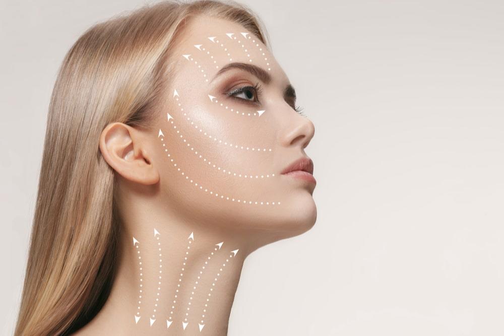 Smartfacelift (İzsiz Akıllı Yüz Germe)